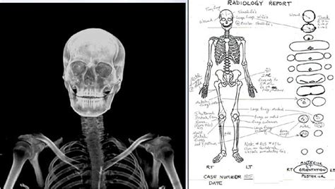 kurt cobain autopsy report: saddam autopsy video