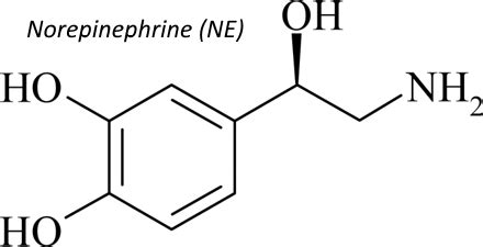 Early vs Delayed Norepinephrine Use in Septic Shock | Epomedicine