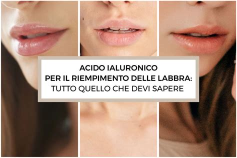 Acido ialuronico per il riempimento delle labbra: tutto quello che devi sapere | OGMedica ...