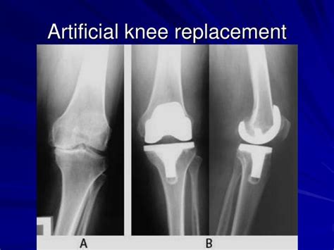 PPT - Lower Extremities PowerPoint Presentation - ID:2148842