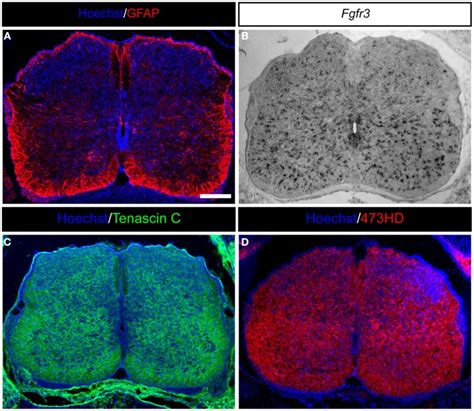 Expression of astrocyte markers and ECM molecules in the developing... | Download Scientific Diagram