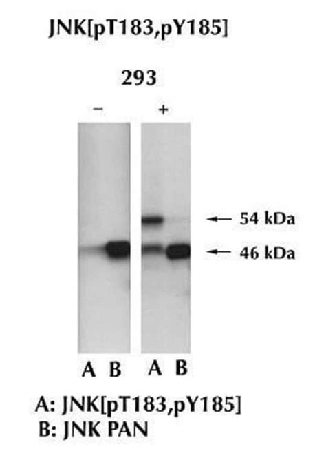 JNK1 Polyclonal Antibody, Invitrogen 100 μL; Unconjugated:Antibodies ...