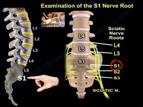 Nerve Root - Nerve Roots : Pain relief also makes you more comfortable ...