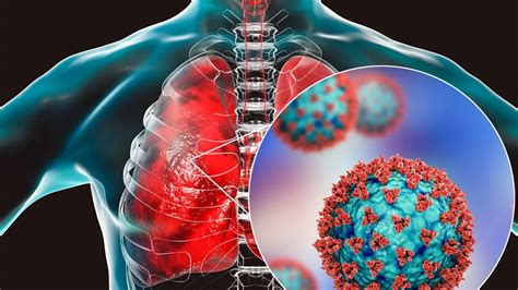 Respiratory Diseases: Understanding The Threat - OrcaMedical.ge