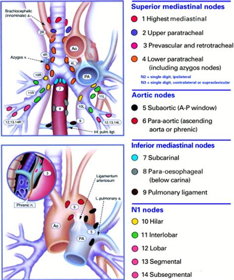 The mediastinal nodes | Anatomy of the mediastinal nodes | Physiology ...