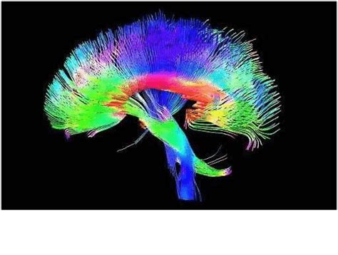 HOW CAN DIFFUSION TENSOR IMAGING MRI HELP IN BRAIN INJURY?