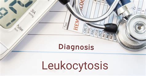 High White Blood Cell Counts and Leukocytosis - Facty Health