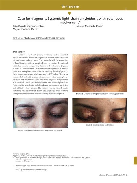 (PDF) Case for diagnosis. Systemic light chain amyloidosis with cutaneous involvement