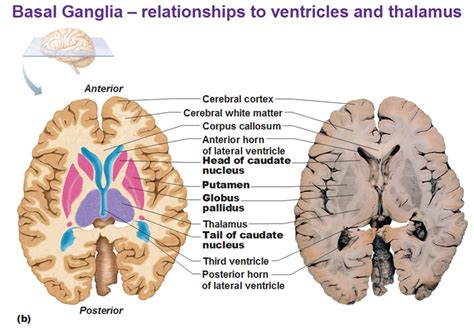 Cerebral White Matter and Gray Matter and Basal Ganglia - Antranik.org