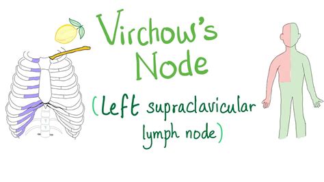 Supraclavicular Lymph Nodes Location