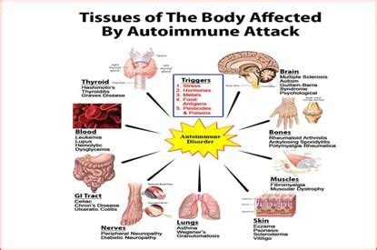 Can Gluten Influence Arthritis Symptoms - CNY Celiac Support Group