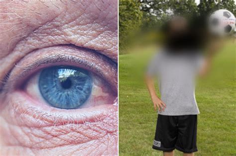 Macular Degeneration: Symptoms, Causes, and Treatment | College Review ...