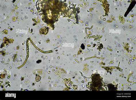 soil microorganisms close up under the microscope. in a soil samlple ...