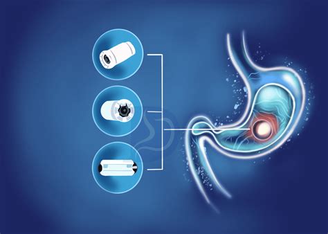 Capsule Endoscopy Nashville- Digestive & Liver Health Specialists