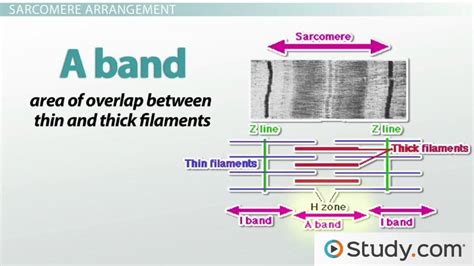 Sarcomere | Definition, Parts & Function - Video & Lesson Transcript ...