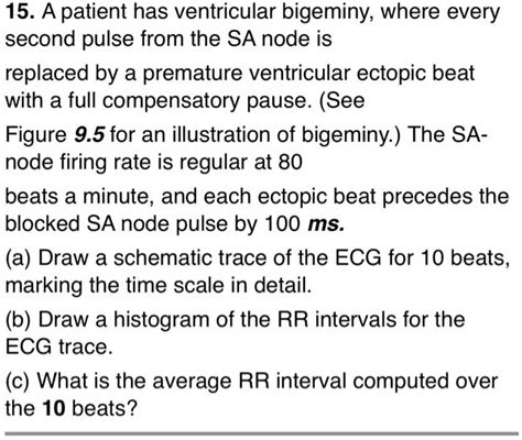 Ventricular Bigeminy Symptoms