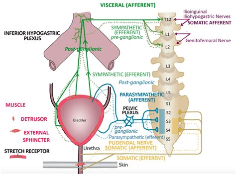 Iliohypogastric Nerve Pain