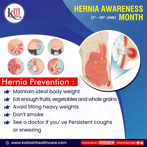 Hernia Awareness Month (1st – 30th June 2021)