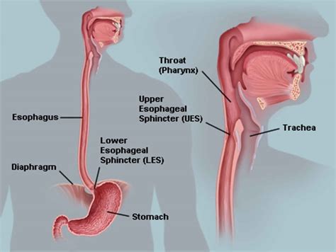 Esophageal dysmotility, esophageal motility disorder, causes, symptoms ...