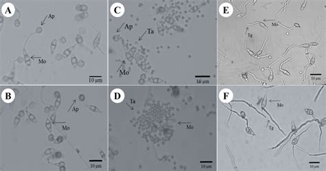 Conidia germination and appressoria formation of M. oryzae in control... | Download Scientific ...