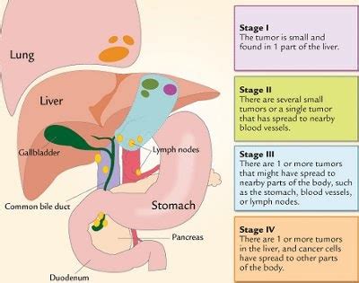 HCV New Drugs: HCC Or Primary Cancer of the Liver