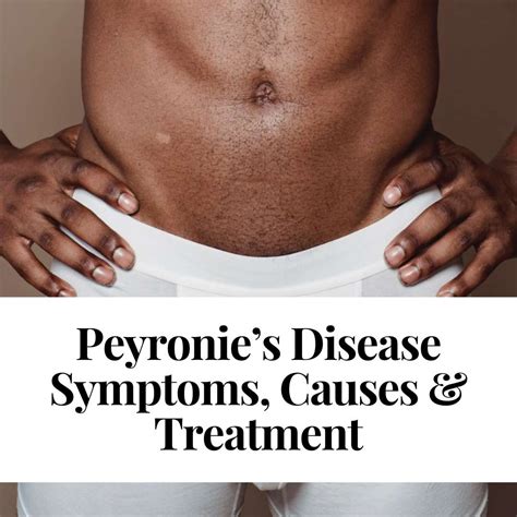 Peyronie’s Disease Symptoms, Causes & Treatment