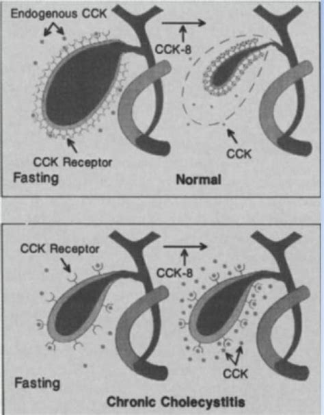 Imaging: Cholescintigraphy: Normal Findings