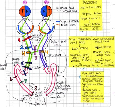 My Notes for USMLE — VISUAL PATHWAY & VISUAL FIELD LESIONS | Medicine notes, Medical school ...