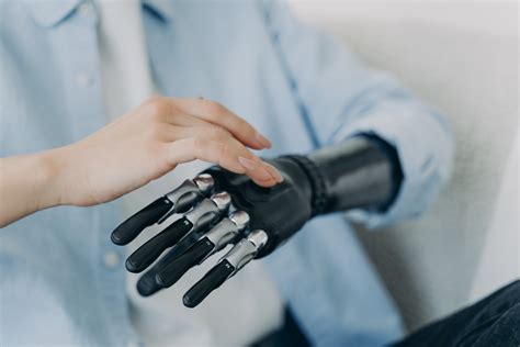 Man With Amputated Arm Gets Bionic Hand in Surgical Breakthrough - Newsweek