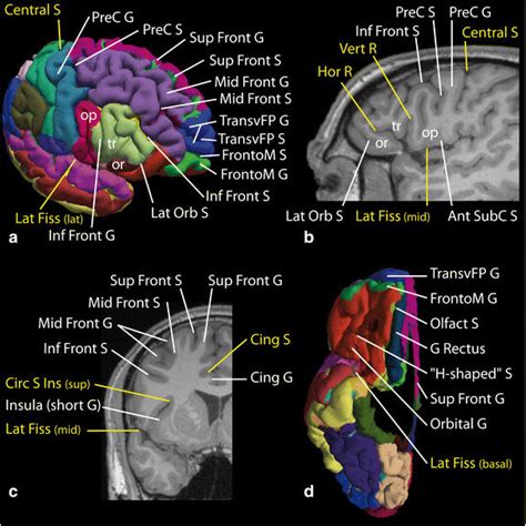 Identification of the sulci and gyri of the frontal lobe (lateral and... | Download Scientific ...