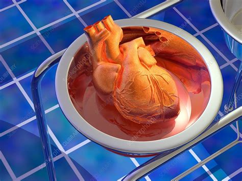 Heart surgery, artwork - Stock Image - M172/0675 - Science Photo Library