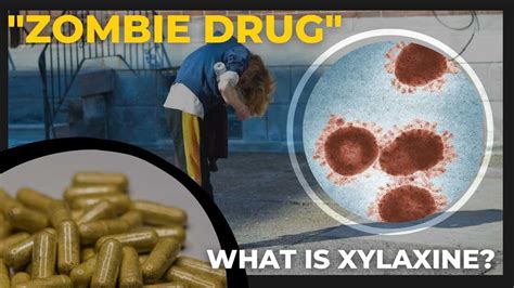 What Is Xylazine? How Is The Drug 'Zombifying' People’s Bodies? All You Need To Know