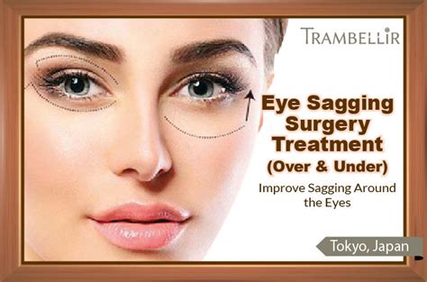 Eye Sagging Surgery Treatment (Improve Sagging Around the Eyes ...