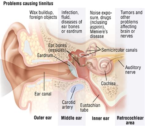 Hearing Loss & Tinnitus Symptoms, Diagnosis & Treatment | Pacific Eye & Ear Center