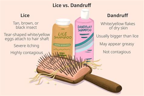 Lice vs. Dandruff: How to Tell the Difference Between Them