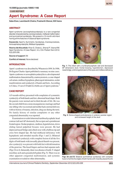 (PDF) Apert Syndrome: A Case Report