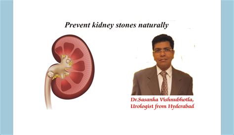 How to prevent kidney stones naturally - Patient Stories | my ...