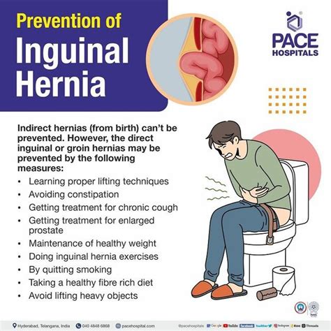 Inguinal Hernia Signs And Symptoms, Types, Causes, Risk, 42% OFF