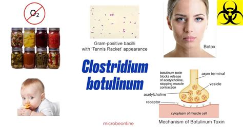 Clostridium botulinum: Properties, Pathogenesis, Lab Diagnosis ...