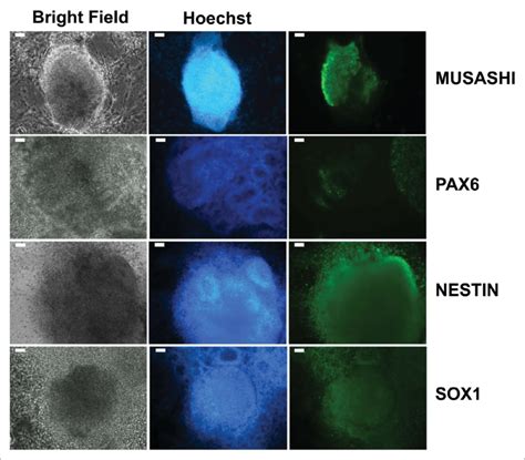 Expression of neural stem cell markers in cellular aggregates... | Download Scientific Diagram