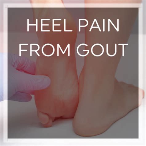 Can Uric Acid Cause Heel Pain? Signs of Gout in the Heel | Heel That Pain