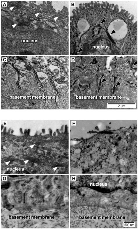 Transmission electron micrograph images of intermediate filaments ...