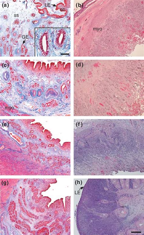 Histology of the intercaruncular and caruncular areas of the uterine ...