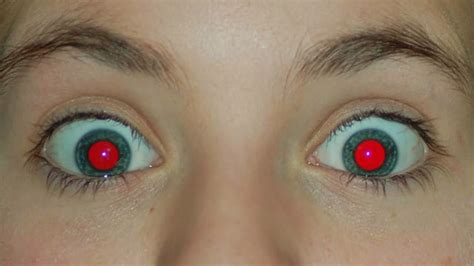 What Causes Red Eye In Photos? - YouTube