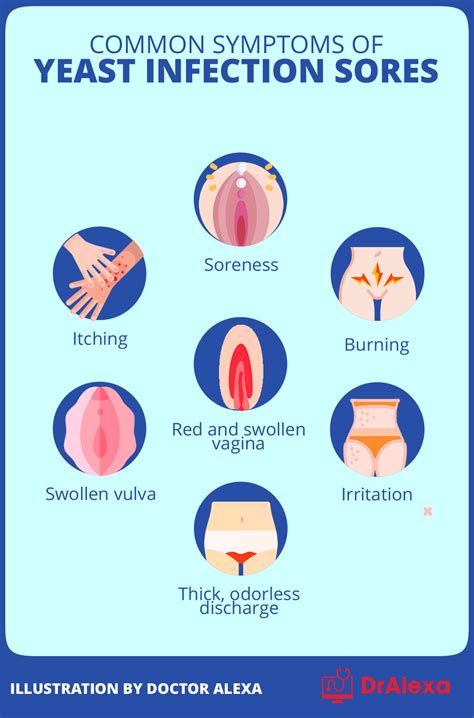 What Do Yeast Infections Smell Like - How to Tell if You Have It