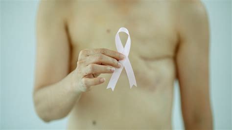 Día Mundial contra el Cáncer de Mama: ¿Cuándo es recomendable realizar una mastectomía preventiva?