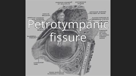 Petrotympanic fissure - YouTube