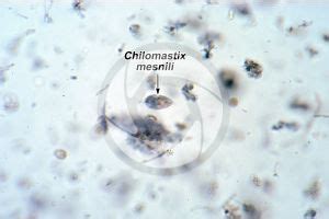 Chilomastix mesnili. 250X - Protozoa (Protozoa) - Endoparasites - Parasitology - Photos