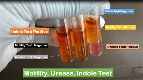 Motility, Urease, Indole Test: Uses, Principle, Composition, Procedure