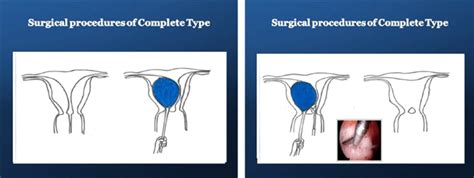 Development & Reproduction